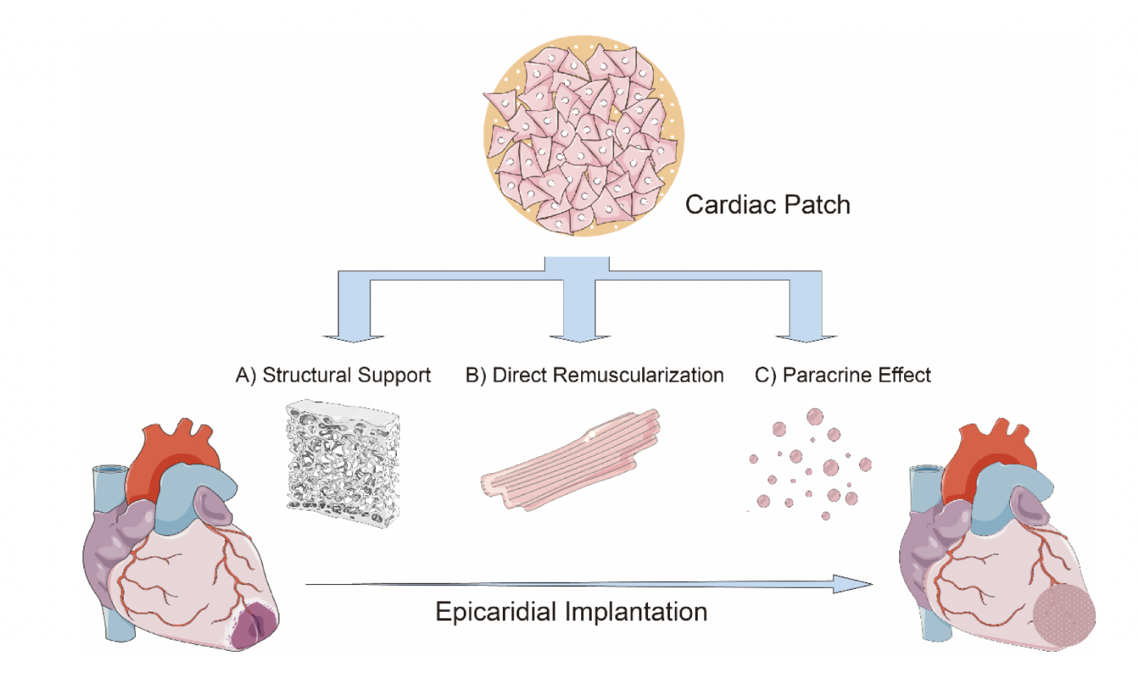 Patching the scarred heart - Browse Articles - Conditioning Medicine